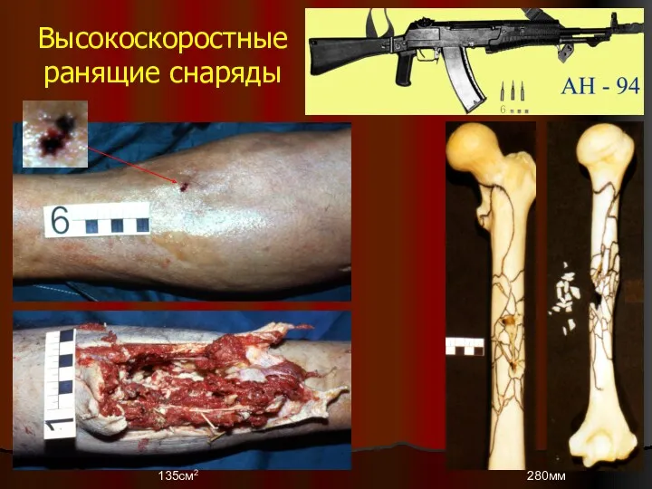 Высокоскоростные ранящие снаряды 135см2 280мм