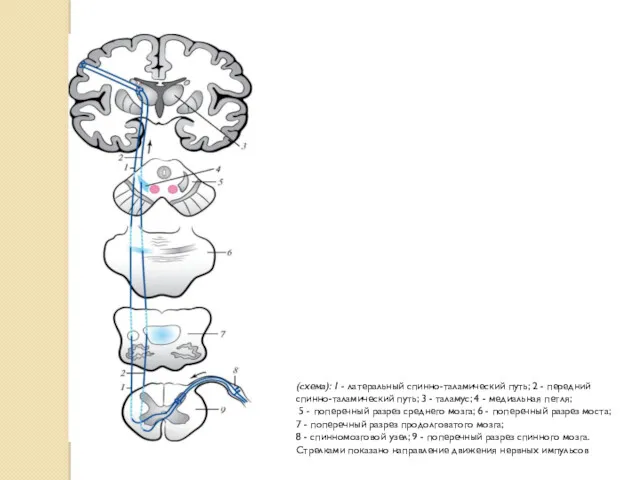 (схема): 1 - латеральный спинно-таламический путь; 2 - передний спинно-таламический
