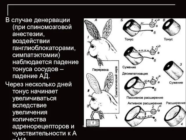 В случае денервации (при спиномозговой анестезии, воздействии ганглиоблокаторами, симпатэктомии) наблюдается