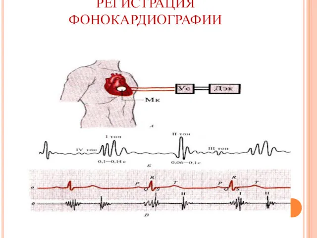 РЕГИСТРАЦИЯ ФОНОКАРДИОГРАФИИ