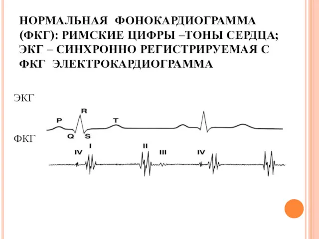 НОРМАЛЬНАЯ ФОНОКАРДИОГРАММА (ФКГ): РИМСКИЕ ЦИФРЫ –ТОНЫ СЕРДЦА; ЭКГ – СИНХРОННО РЕГИСТРИРУЕМАЯ С ФКГ ЭЛЕКТРОКАРДИОГРАММА ЭКГ ФКГ