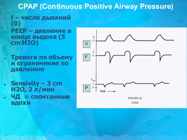 CPAP (Continuous Positive Airway Pressure) f – число дыханий (0)