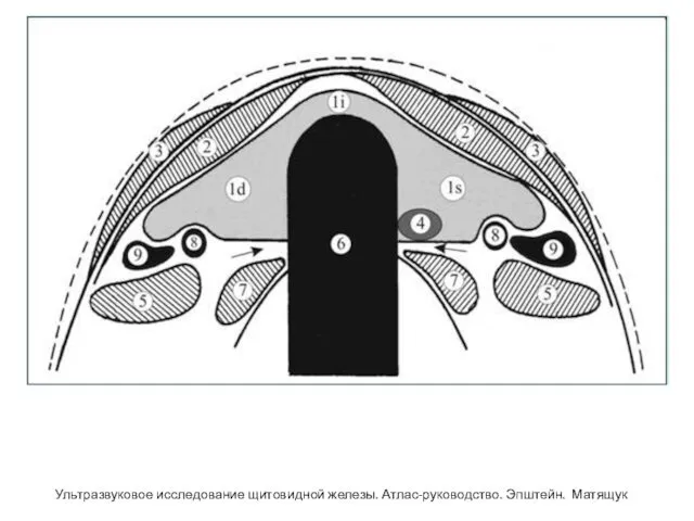 Ультразвуковое исследование щитовидной железы. Атлас-руководство. Эпштейн. Матящук