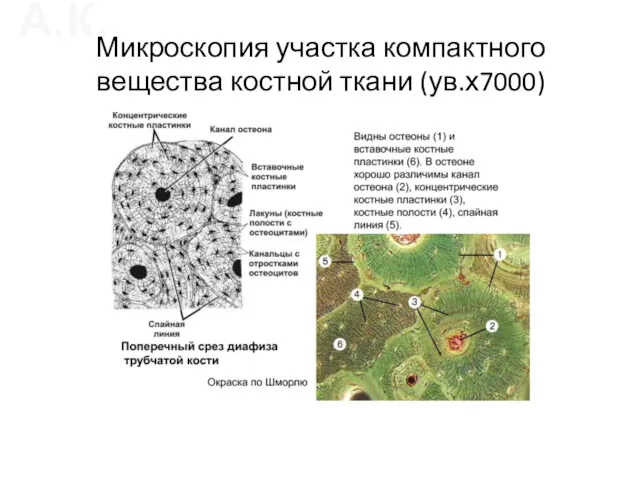 Микроскопия участка компактного вещества костной ткани (ув.х7000)