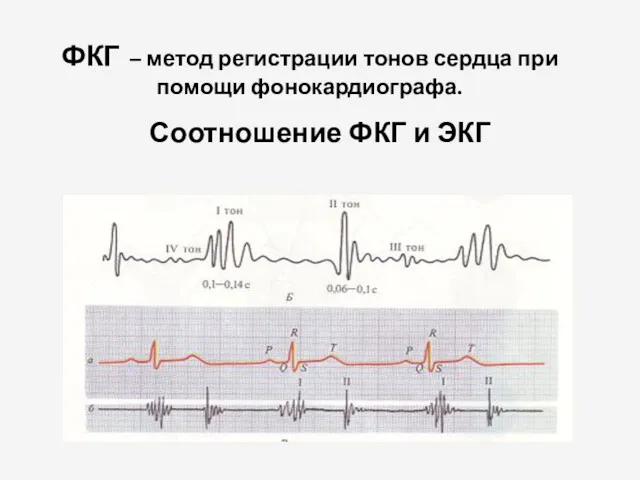 ФКГ – метод регистрации тонов сердца при помощи фонокардиографа. Соотношение ФКГ и ЭКГ