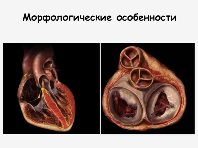 Морфологические особенности