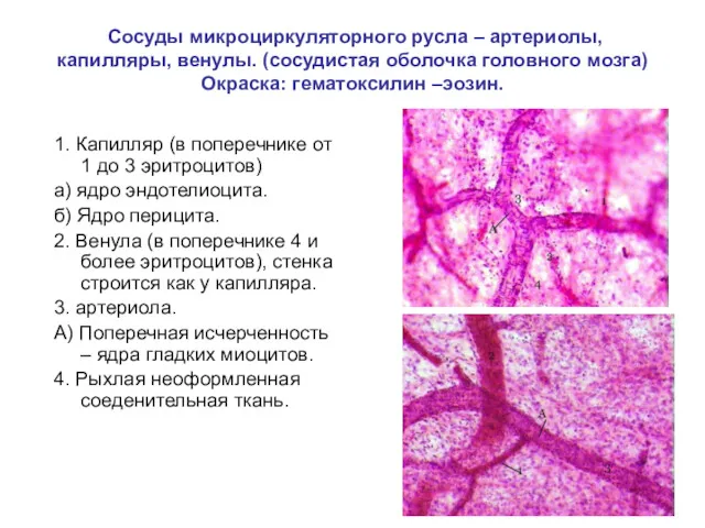 Сосуды микроциркуляторного русла – артериолы, капилляры, венулы. (сосудистая оболочка головного