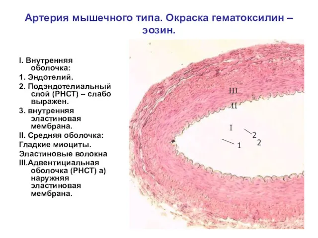Артерия мышечного типа. Окраска гематоксилин – эозин. I. Внутренняя оболочка: