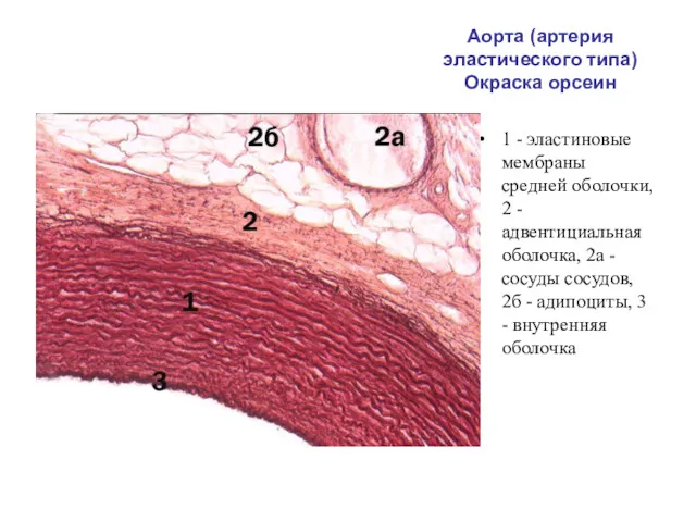 Аорта (артерия эластического типа) Окраска орсеин 1 - эластиновые мембраны