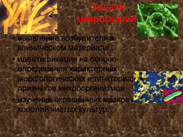 Задачи микроскопии: выявление возбудителя в клиническом материале идентификация на основе