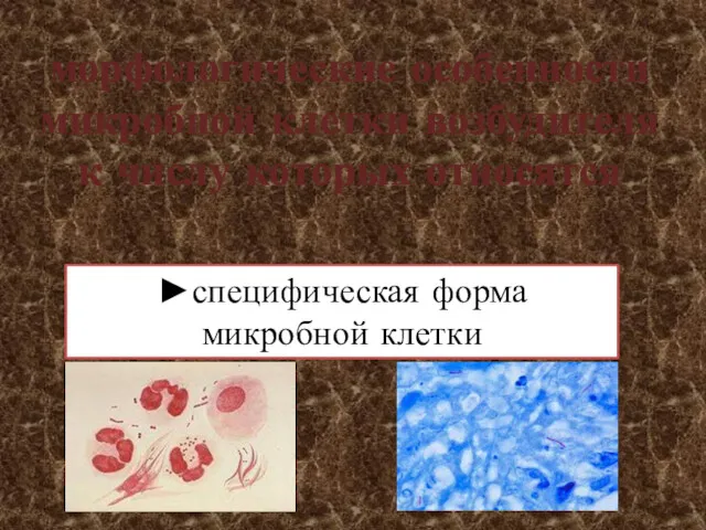 морфологические особенности микробной клетки возбудителя к числу которых относятся ►специфическая форма микробной клетки