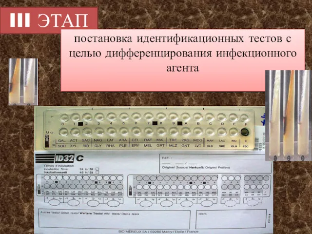 III ЭТАП постановка идентификационных тестов с целью дифференцирования инфекционного агента