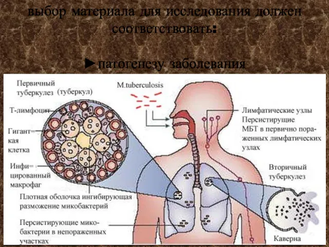 выбор материала для исследования должен соответствовать: ►патогенезу заболевания