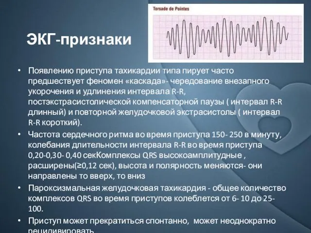 Появлению приступа тахикардии типа пирует часто предшествует феномен «каскада»- чередование