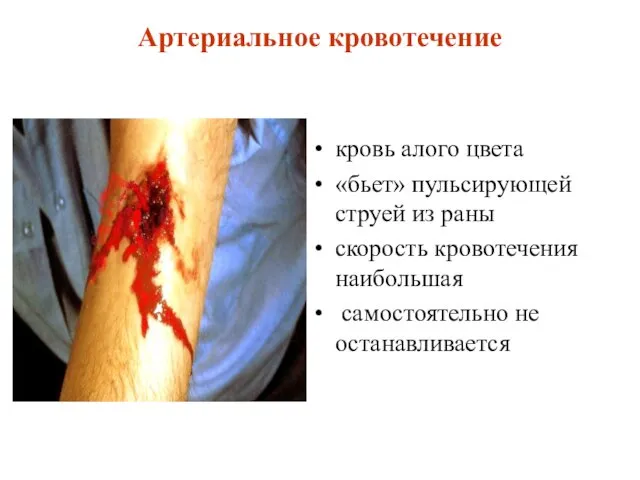 Артериальное кровотечение кровь алого цвета «бьет» пульсирующей струей из раны скорость кровотечения наибольшая самостоятельно не останавливается