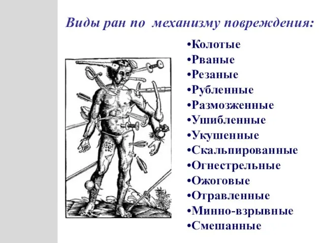 Виды ран по механизму повреждения: Колотые Рваные Резаные Рубленные Размозженные