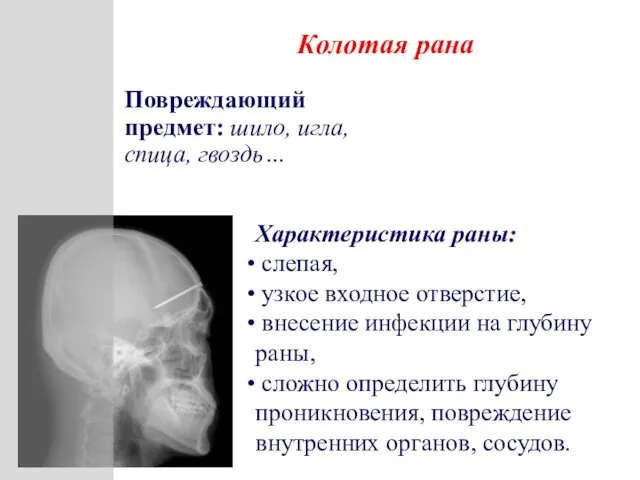 Характеристика раны: слепая, узкое входное отверстие, внесение инфекции на глубину