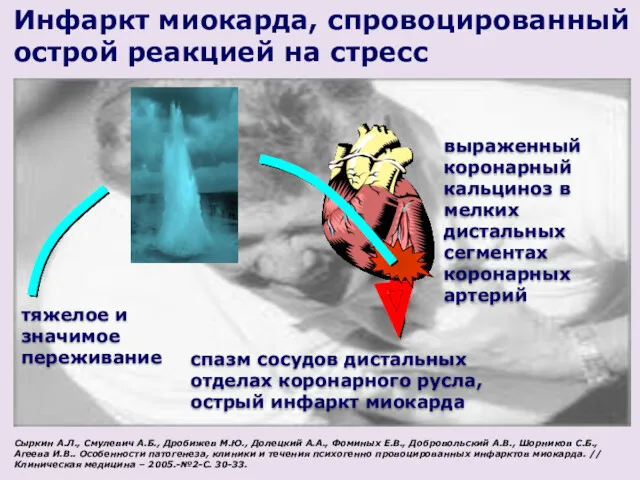 тяжелое и значимое переживание спазм сосудов дистальных отделах коронарного русла,