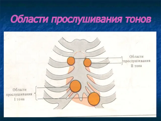 Области прослушивания тонов