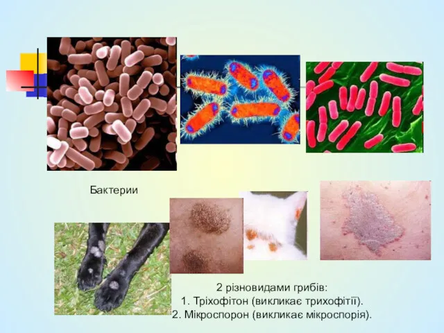 Бактерии 2 різновидами грибів: 1. Тріхофітон (викликає трихофітії). 2. Мікроспорон (викликає мікроспорія).