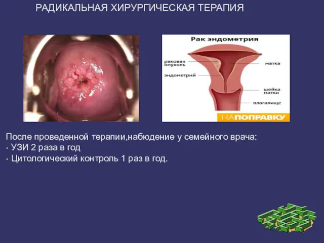 РАДИКАЛЬНАЯ ХИРУРГИЧЕСКАЯ ТЕРАПИЯ После проведенной терапии,набюдение у семейного врача: • УЗИ 2 раза