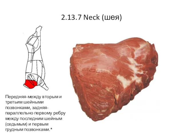 2.13.7 Neck (шея) Передняя-между вторым и третьим шейными позвонками, задняя-параллельно