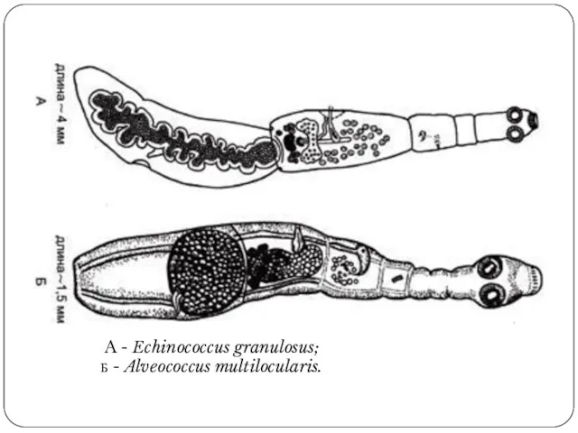 A - Echinococcus granulosus; Б - Alveococcus multilocularis.