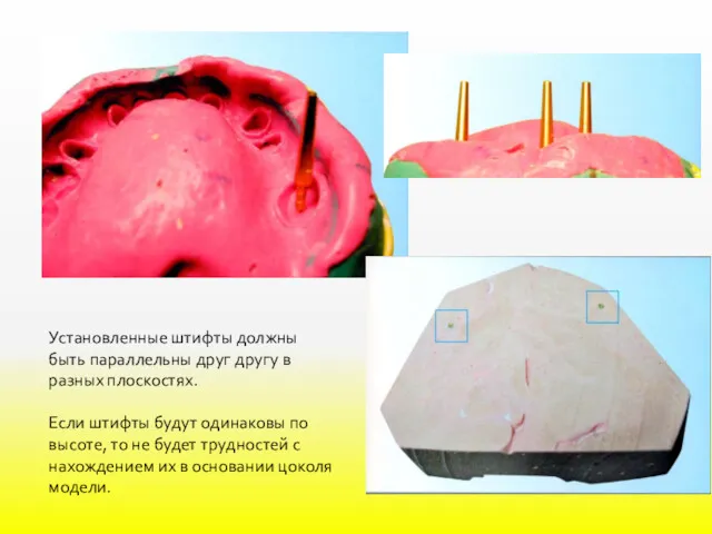 Установленные штифты должны быть параллельны друг другу в разных плоскостях. Если штифты будут