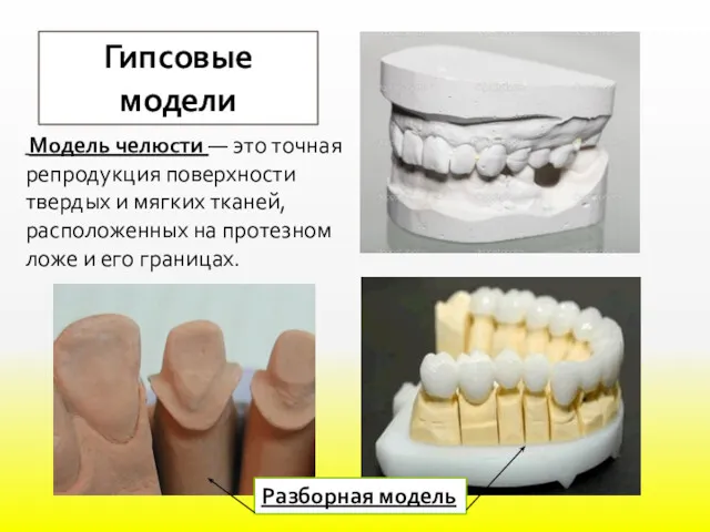 Гипсовые модели Модель челюсти — это точная репродукция поверхности твердых и мягких тканей,