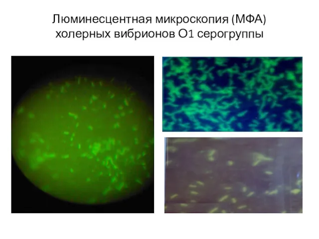 Люминесцентная микроскопия (МФА) холерных вибрионов О1 серогруппы