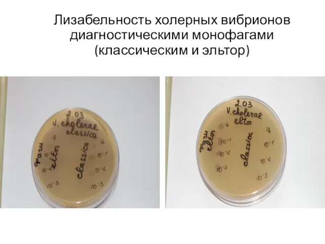 Лизабельность холерных вибрионов диагностическими монофагами (классическим и эльтор)