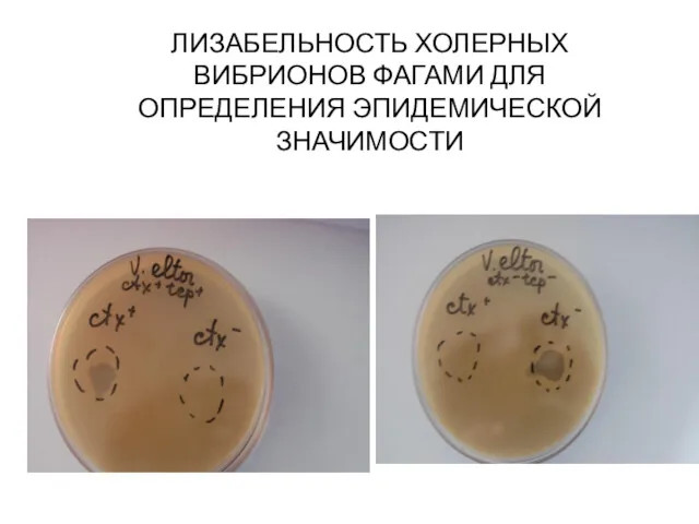 ЛИЗАБЕЛЬНОСТЬ ХОЛЕРНЫХ ВИБРИОНОВ ФАГАМИ ДЛЯ ОПРЕДЕЛЕНИЯ ЭПИДЕМИЧЕСКОЙ ЗНАЧИМОСТИ