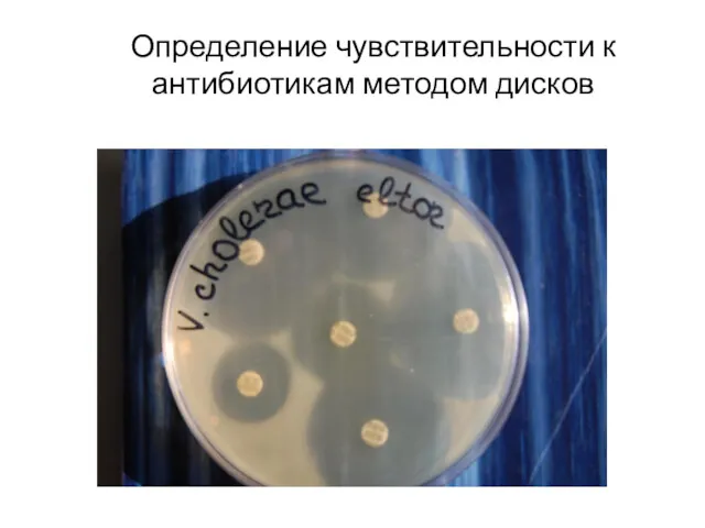 Определение чувствительности к антибиотикам методом дисков