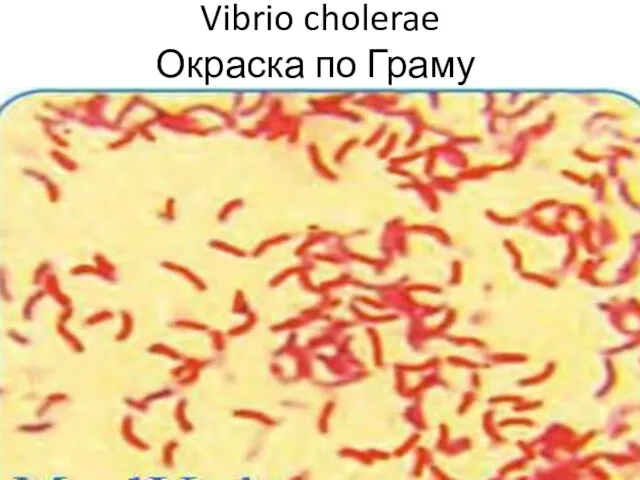 Vibrio cholerae Окраска по Граму