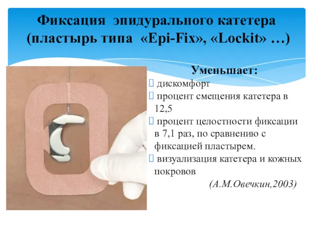 Фиксация эпидурального катетера (пластырь типа «Epi-Fix», «Lockit» …) Уменьшает: дискомфорт