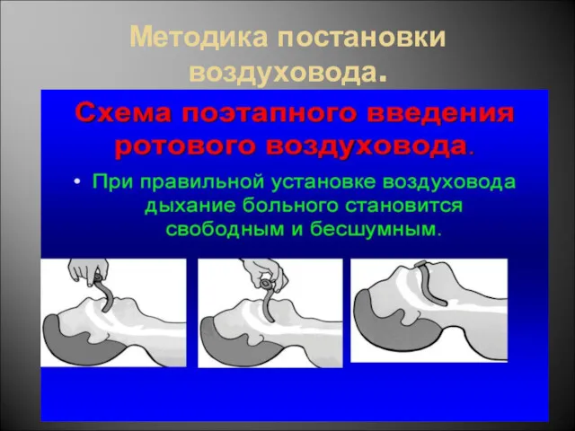 Методика постановки воздуховода.