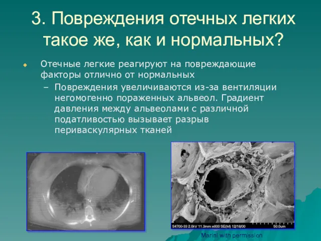 3. Повреждения отечных легких такое же, как и нормальных? Отечные