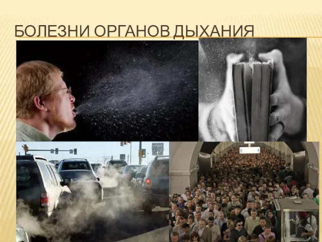 БОЛЕЗНИ ОРГАНОВ ДЫХАНИЯ