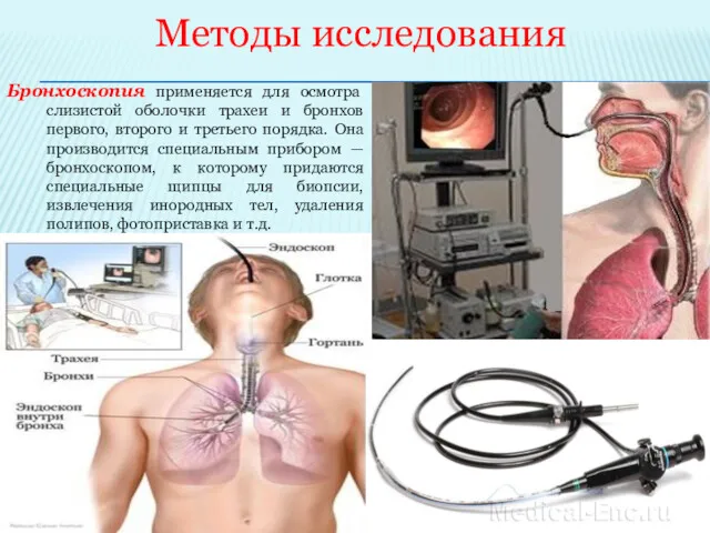 Методы исследования Бронхоскопия применяется для осмотра слизистой оболочки трахеи и бронхов первого, второго