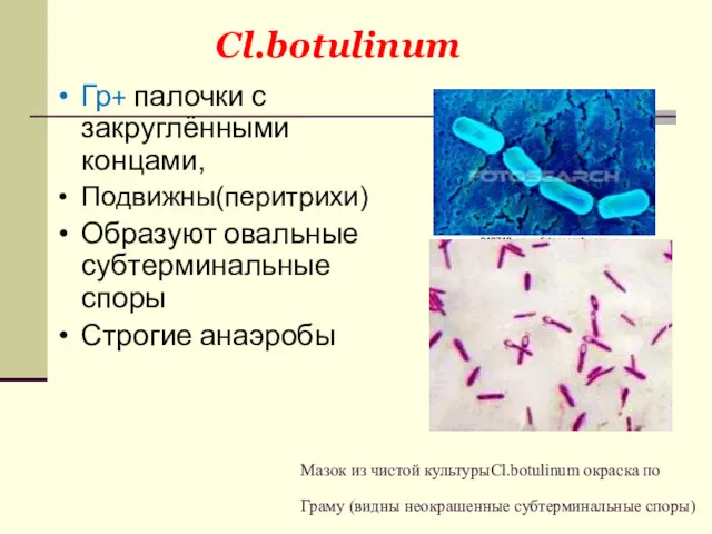 Мазок из чистой культурыCl.botulinum окраска по Граму (видны неокрашенные субтерминальные