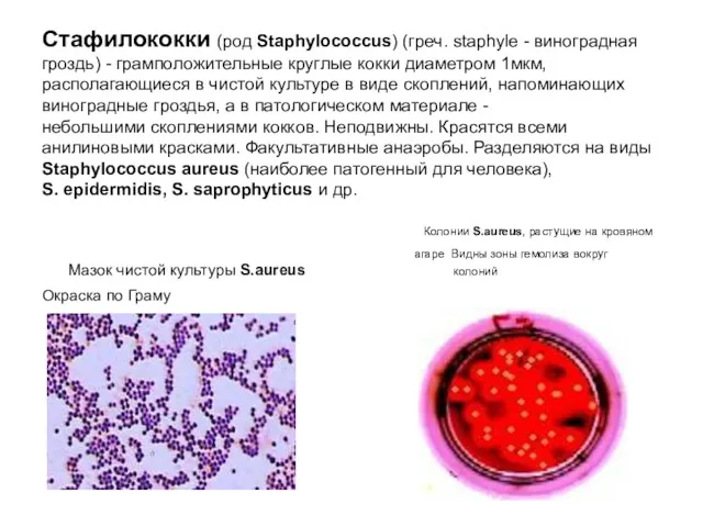 Стафилококки (род Staphylococcus) (греч. staphyle - виноградная гроздь) - грамположительные