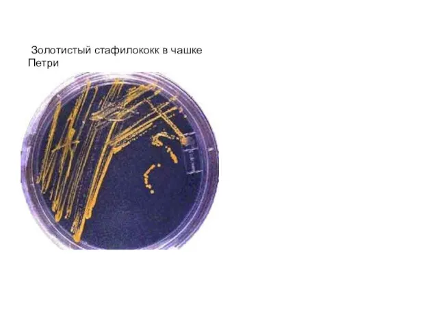 Золотистый стафилококк в чашке Петри