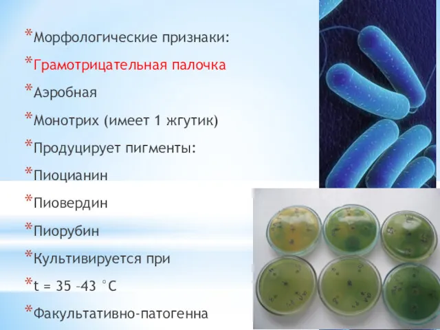 Морфологические признаки: Грамотрицательная палочка Аэробная Монотрих (имеет 1 жгутик) Продуцирует