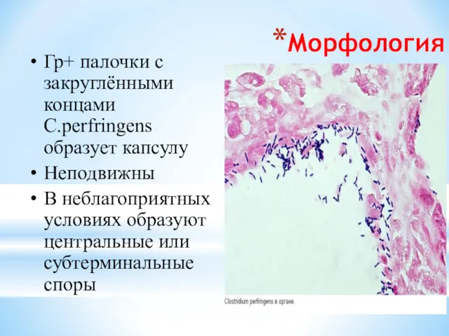 Морфология Гр+ палочки с закруглёнными концами C.perfringens образует капсулу Неподвижны