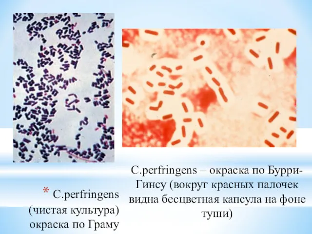 C.рerfringens (чистая культура) окраска по Граму C.рerfringens – окраска по