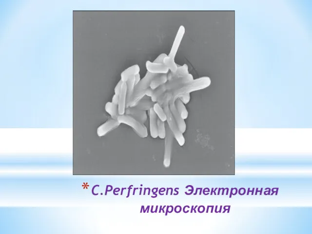 C.Perfringens Электронная микроскопия