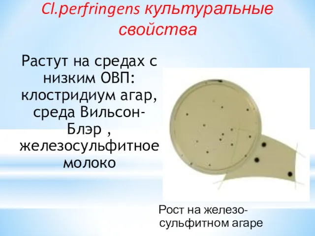 Растут на средах с низким ОВП: клостридиум агар, среда Вильсон-Блэр