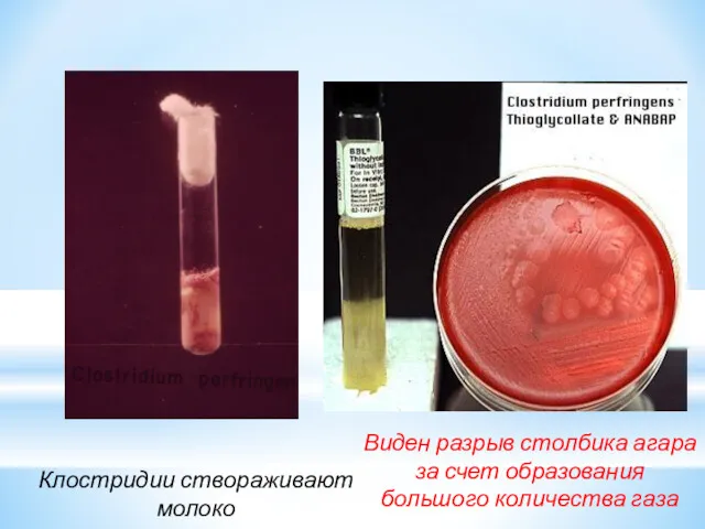 Клостридии створаживают молоко Виден разрыв столбика агара за счет образования большого количества газа