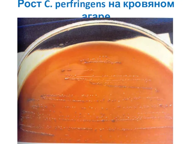 Рост C. perfringens на кровяном агаре