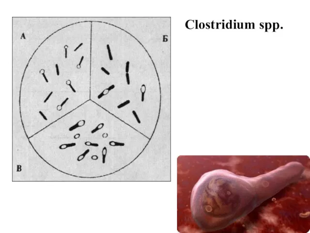 Clostridium spp.